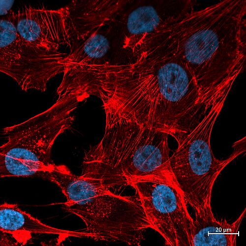 Fluorescence microscopy: MG-63 osteoblasts imaged by Dr. Susanne Stählke using the new LSM 990 system in Airyscan mode